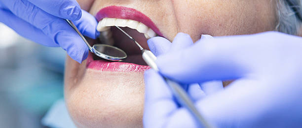 Best Emergency Tooth Extraction in Bemiss, GA